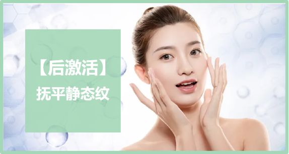 撫平靜態(tài)紋.png