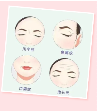 動(dòng)態(tài)紋情況.png