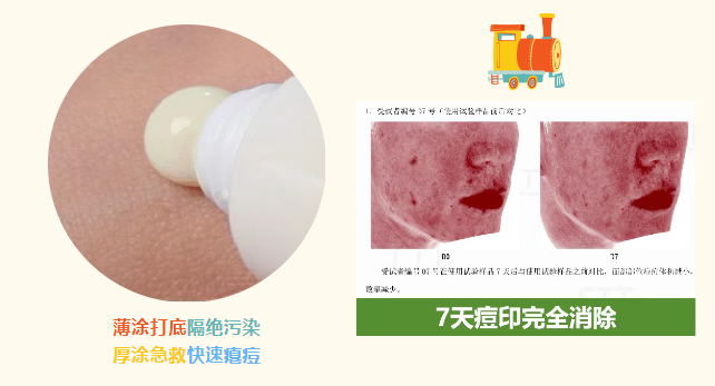 水楊酸祛痘精華液代加工