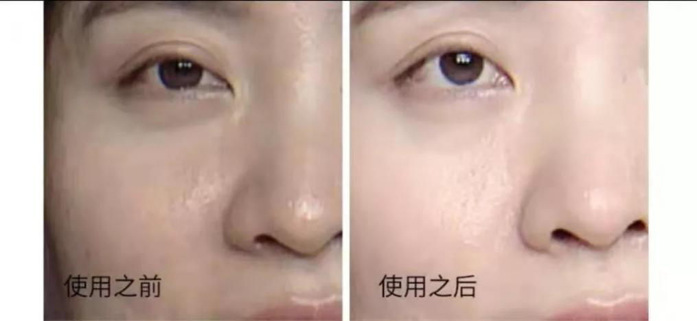 面霜使用前后對(duì)比照片