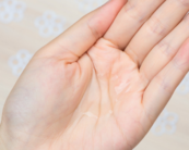 奧蓓斯祛痘印怎么樣？奧蓓斯祛痘印用法