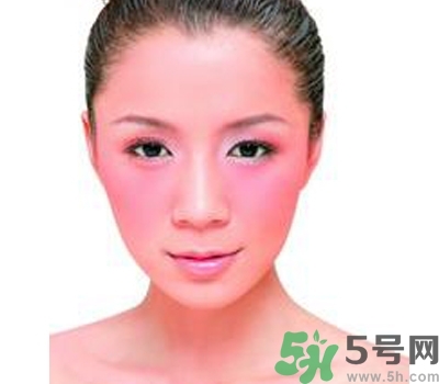 敏感性皮膚用什么洗面奶？敏感性皮膚怎么修復？