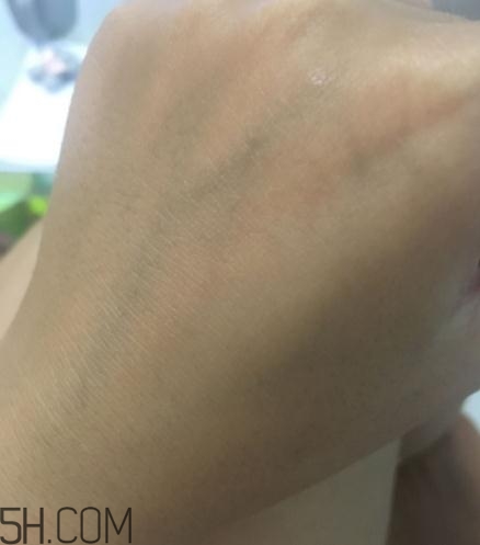 奧蓓斯彈力蛋白霜多少錢(qián)？奧蓓斯彈力蛋白霜適合膚質(zhì)