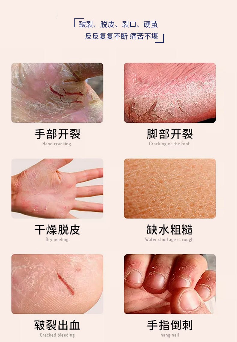1635929401583667.jpg 防裂護足裂可寧霜50g護手霜_03.jpg
